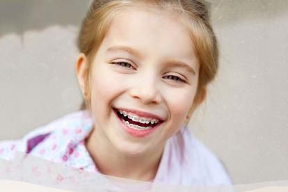 Có nên niềng răng cho trẻ 7 tuổi hay không? Bạn cần biết những gì?
