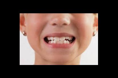 Những thói quen gây hại đến hàm răng của bạn